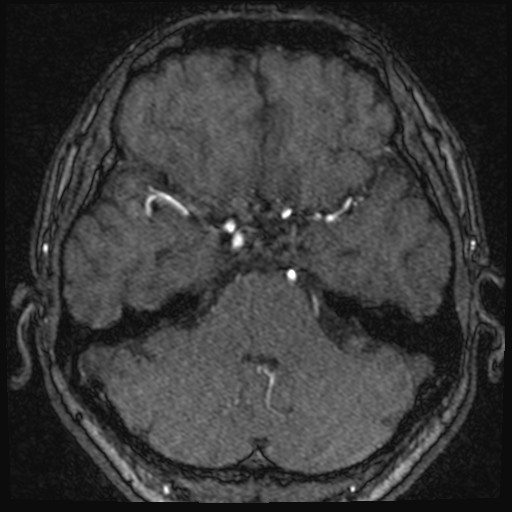 Click on the Serie image to view the images of VILLANUEVA, WILLIAM A.